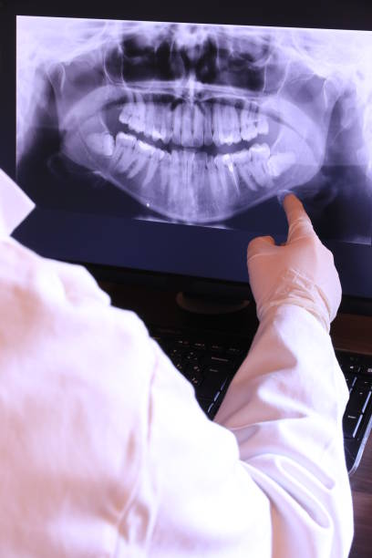 Best Teeth Whitening  in Bort, GA